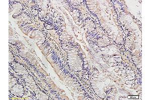 Immunohistochemistry (IHC) image for anti-Insulin-Degrading Enzyme (IDE) (AA 491-590) antibody (ABIN723680)