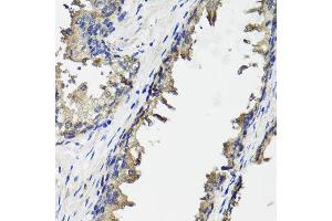Immunohistochemistry of paraffin-embedded human prostate using OTC antibody at dilution of 1:100 (x40 lens).