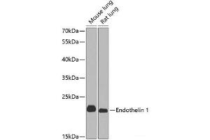 Western blot analysis of extracts of various cell lines using Endothelin 1 Polyclonal Antibody at dilution of 1:1000. (Endothelin 1 antibody)