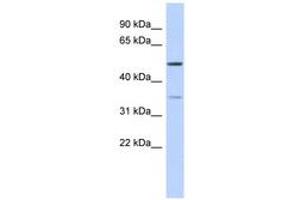 Image no. 1 for anti-Cholesteryl Ester Transfer Protein (CETP) (AA 395-444) antibody (ABIN6743589)