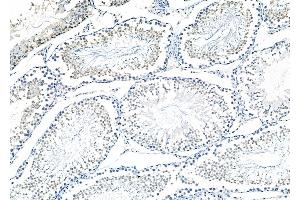 ABIN6257570 and ABIN6273546 at 1/100 staining Rat testis tissue by IHC-P.