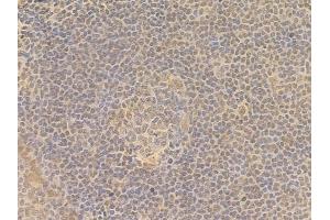 ABIN7095684 and ABIN7099746 at 1/100 staining human normal tonsil tissue by IHC-P. (KLHL26 antibody)