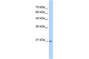 WB Suggested Anti-PTGDS Antibody Titration:  1 ug/ml  Positive Control:  HepG2 cell lysate (PTGDS antibody  (N-Term))