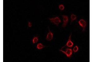 ABIN6277830 staining NIH-3T3 by IF/ICC. (LAT antibody  (Internal Region))