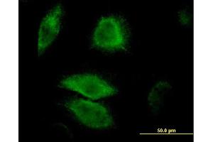 Immunofluorescence of monoclonal antibody to DUSP6 on HeLa cell. (DUSP6 antibody  (AA 1-381))