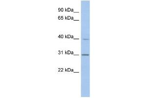 WB Suggested Anti-PERLD1 Antibody Titration:  0. (PGAP3 antibody  (N-Term))