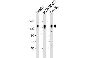 Western Blotting (WB) image for anti-Interleukin 6 Signal Transducer (Gp130, Oncostatin M Receptor) (IL6ST) (AA 871-899), (C-Term) antibody (ABIN655059)