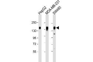 All lanes : Anti-C Antibody (C-term) at 1:2000 dilution Lane 1: HepG2 whole cell lysate Lane 2: MDA-MB-231 whole cell lysate Lane 3: S whole cell lysate Lysates/proteins at 20 μg per lane.
