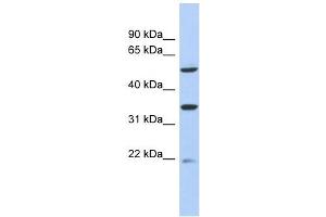 MGC34821 antibody used at 1 ug/ml to detect target protein. (MGC34821 (Middle Region) antibody)