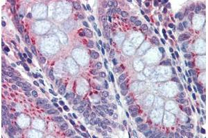 Human Colon: Formalin-Fixed, Paraffin-Embedded (FFPE) (BACE2 antibody  (C-Term))