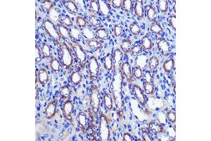 Immunohistochemistry of paraffin-embedded Mouse kidney using LETMD1 Rabbit pAb (ABIN3023040, ABIN3023041, ABIN3023042, ABIN1513151 and ABIN6219360) at dilution of 1:100 (40x lens). (LETMD1 antibody  (AA 161-360))