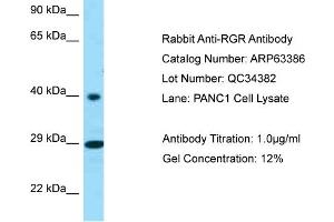 Western Blotting (WB) image for anti-Retinal G Protein Coupled Receptor (RGR) (C-Term) antibody (ABIN971566) (RGR antibody  (C-Term))
