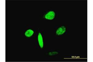 Immunofluorescence of monoclonal antibody to FOXA2 on HeLa cell. (FOXA2 antibody  (AA 363-457))