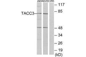 Western blot analysis of extracts from 293 cells and HUVEC cells, using TACC3 antibody.
