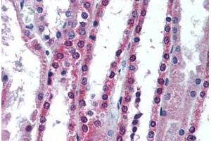 Human Kidney (formalin-fixed, paraffin-embedded) stained with APIP antibody ABIN292116 at 10 ug/ml followed by biotinylated goat anti-rabbit IgG secondary antibody ABIN481713, alkaline phosphatase-streptavidin and chromogen. (APIP antibody)