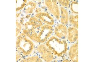 Immunohistochemistry of paraffin-embedded human kidney using PDE4DIP antibody at dilution of 1:100 (40x lens). (PDE4DIP antibody)