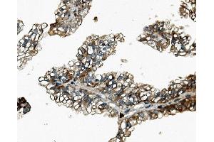 IHC analysis of Rex1/ZFP42 using anti-Rex1/ZFP42 antibody (ABIN7600901). (ZFP42 antibody  (AA 25-310))