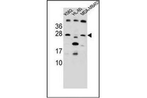 Western blot analysis of DKK4 Antibody (C-term) in K562,HL-60, MDA-MB453 cell line lysates (35ug/lane).