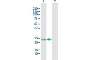 Western Blot analysis of C9orf95 expression in transfected 293T cell line by C9orf95 MaxPab polyclonal antibody. (NMRK1 antibody  (AA 1-199))
