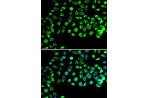 Immunofluorescence analysis of A549 cells using C16orf80 antibody.