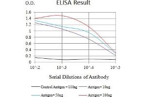 Black line: Control Antigen (100 ng),Purple line: Antigen (10 ng), Blue line: Antigen (50 ng), Red line:Antigen (100 ng) (S1PR1 antibody)