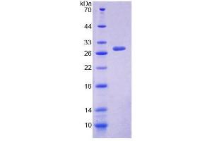 SDS-PAGE (SDS) image for Dystonin (DST) (AA 1-252) protein (His tag) (ABIN4989258) (Dystonin Protein (DST) (AA 1-252) (His tag))
