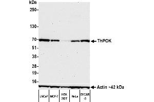 Western Blotting (WB) image for anti-ThPok (AA 250-300) antibody (ABIN7455169) (Recombinant ThPok (AA 250-300) antibody)