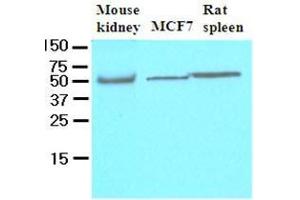 Cell lysates of mouse kidney, MCF7 and rat spleen (40 ug) were resolved by SDS-PAGE, transferred to nitrocellulose membrane and probed with anti-human FLIP (1:500). (FLIP antibody  (AA 1-376))