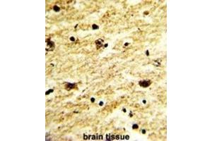 Immunohistochemistry (IHC) image for anti-Exosome Component 8 (EXOSC8) antibody (ABIN3001629) (EXOSC8 antibody)