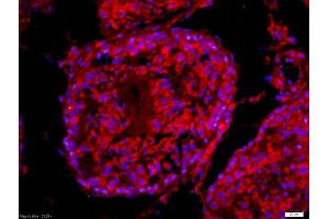 Formalin-fixed and paraffin-embedded rat testis labeled with Anti-PLCZ1 Polyclonal Antibody, Unconjugated (ABIN801183) 1:200, overnight at 4°C, The secondary antibody was Goat Anti-Rabbit IgG,Cy3 conjugated used at 1:200 dilution for 40 minutes at 37°C. (PLCz1 antibody  (AA 351-450))