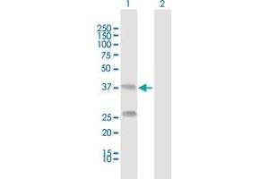 Western Blot analysis of C4BPB expression in transfected 293T cell line by C4BPB MaxPab polyclonal antibody.