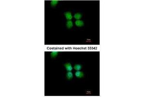 ICC/IF Image Immunofluorescence analysis of paraformaldehyde-fixed A431, using ORC4L, antibody at 1:500 dilution. (ORC4 antibody  (C-Term))
