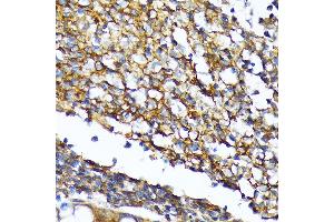 Immunohistochemistry of paraffin-embedded human colon using CD82 Rabbit mAb (ABIN7266222) at dilution of 1:100 (40x lens). (CD82 antibody)