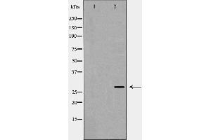 Western blot analysis of VEGF expression in A431 cells,The lane on the left is treated with the antigen-specific peptide.