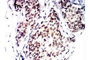 Immunohistochemistry (IHC) image for anti-PMS2 Postmeiotic Segregation Increased 2 (S. Cerevisiae) (PMS2) antibody (ABIN7193691)