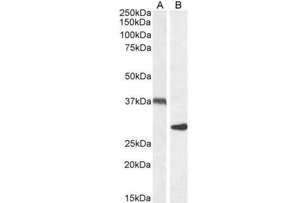 UCP2 antibody  (Internal Region)