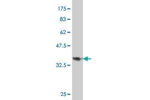 Western Blot detection against Immunogen (38. (PTPLAD1 antibody  (AA 1-113))