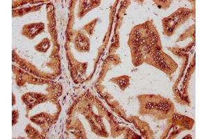 IHC image of ABIN7160228 diluted at 1:600 and staining in paraffin-embedded human prostate tissue performed on a Leica BondTM system. (SMAD2 antibody  (AA 2-467))