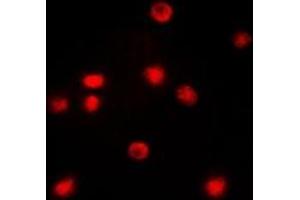 Immunofluorescent analysis of C/EBP zeta staining in COLO205 cells. (DDIT3 antibody  (N-Term))
