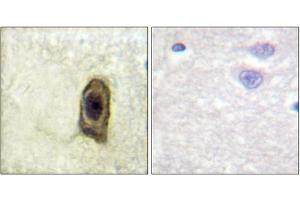 Immunohistochemical analysis of paraffin-embedded human brain, using CSFR (Phospho-Tyr561) antibody (left)or the same antibody preincubated with blocking peptide (right). (CSF1R antibody  (pTyr561))