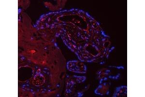 anti-Tumor Protein P53 Inducible Protein 13 (TP53I13) (AA 30-365) antibody