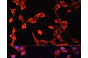 Immunofluorescence analysis of NIH-3T3 cells using ADAMTS13 Polyclonal Antibody at dilution of 1:100 (40x lens). (ADAMTS13 antibody)