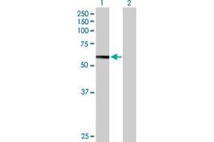 Western Blot analysis of HEXB expression in transfected 293T cell line by HEXB MaxPab polyclonal antibody.
