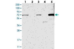 Western blot analysis of Lane 1: RT-4, Lane 2: U-251 MG, Lane 3: Human Plasma, Lane 4: Liver, Lane 5: Tonsil with HSPA12A polyclonal antibody . (HSPA12A antibody)