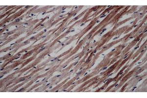 Immunohistochemistry of paraffin-embedded Rat heart using CD297 Polyclonal Antibody at dilution of 1:50 (ART4 antibody)