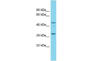 Host:  Rabbit  Target Name:  RGD1305007  Sample Type:  Rat Testis lysates  Antibody Dilution:  1. (OGFOD3 antibody  (N-Term))