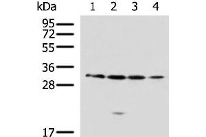 Western blot analysis of 293T A549 Jurkat 231 cell lysates using RCHY1 Polyclonal Antibody at dilution of 1:650 (RCHY1 antibody)
