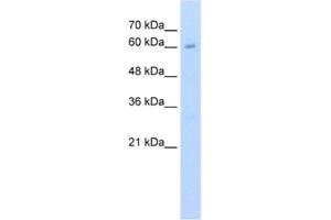 Western Blotting (WB) image for anti-Methyltransferase Like 13 (METTL13) antibody (ABIN2462483) (METTL13 antibody)