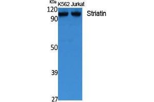 Western Blotting (WB) image for anti-Striatin (STRN) (C-Term) antibody (ABIN3187649) (Striatin antibody  (C-Term))