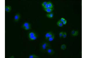 Immunofluorescence staining of HepG2 cells with ABIN7127445 at 1:76, counter-stained with DAPI. (Recombinant Aromatase antibody)